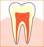 caries01.jpg