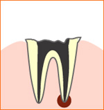 caries01.jpg